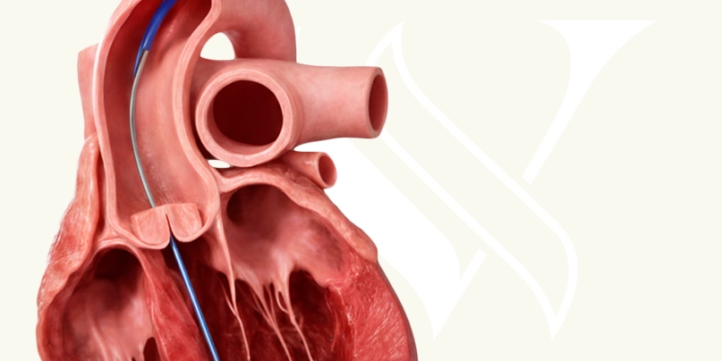 Imagem Cirurgia de Revascularização