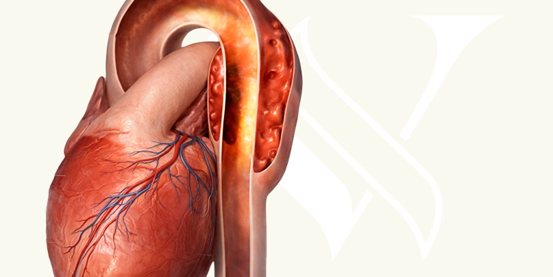 Imagem Cirurgia de Revascularização